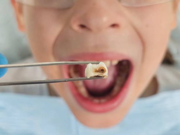 Best Broken Tooth Emergency  in Anchorage, KY