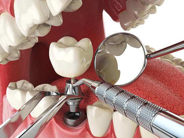 Best Tooth Infection Emergency Dentist  in Anchorage, KY